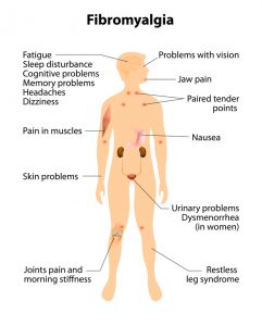 signs and symptoms of fibromyalgia. Human silhouette with internal organs. Vector illustration